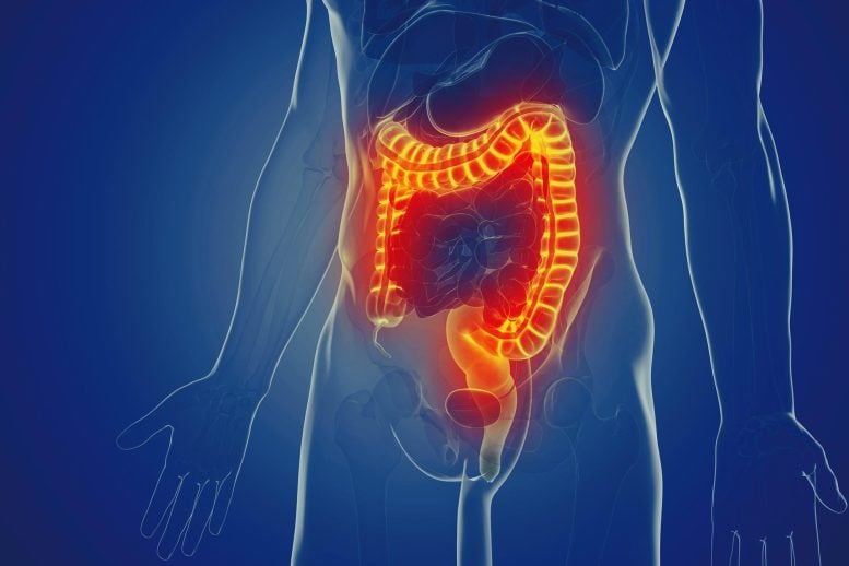 A Single Gene May Decide How Well Your Gut Fights Harmful Bacteria Human Anatomy Man Large Intestine