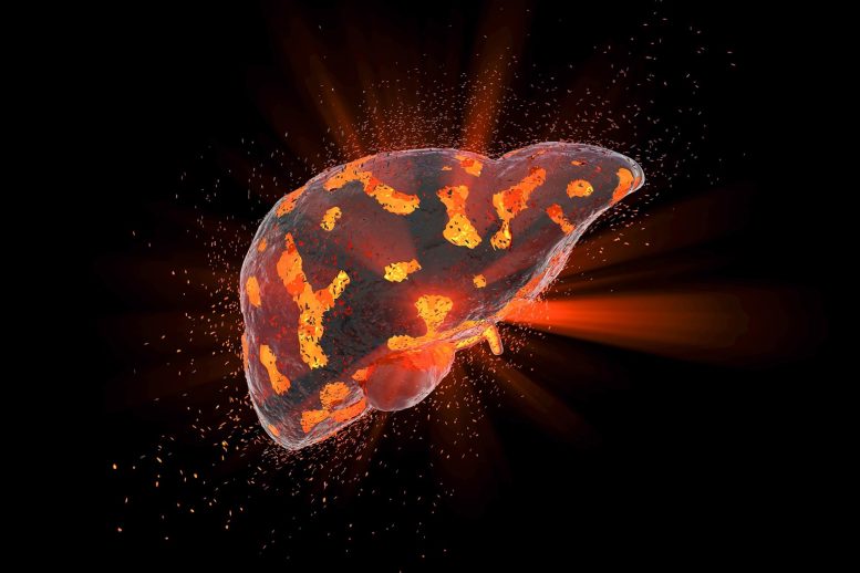 Scientists Discover How Rare Liver Cancer Hides From the Immune System Liver Disease Concept Illustration