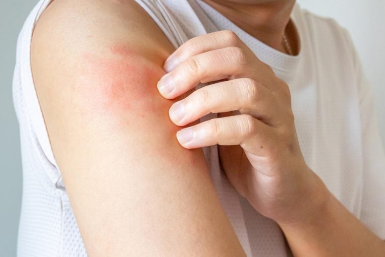 Scientists Discover Why We Know When To Stop Scratching an Itch Young Man Scratching Itchy Skin Allergic Rash